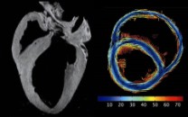 Magnetic Resonance Imaging (MRI)