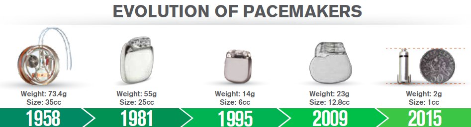 Infographic of the evolution of pacemakers