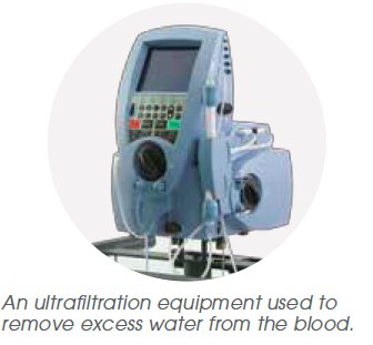 Ultrafiltration Equipment