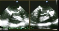 Image of echocardiogram 