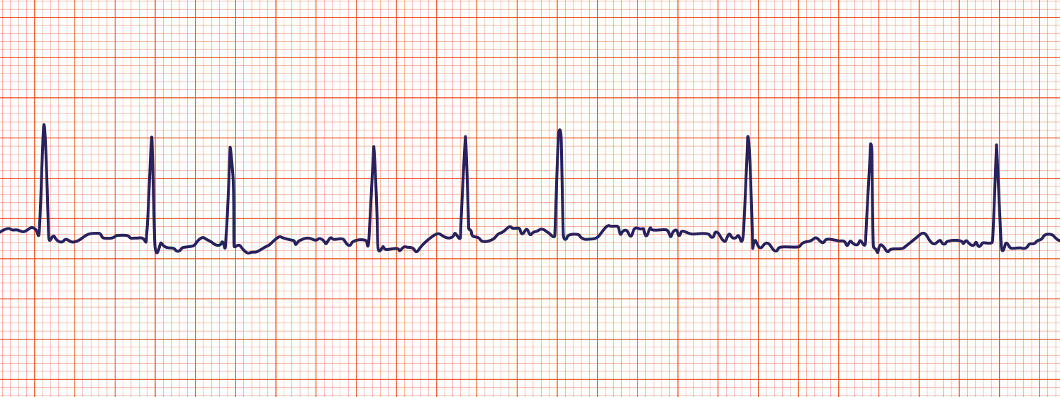 Graphic art of heart beat rate