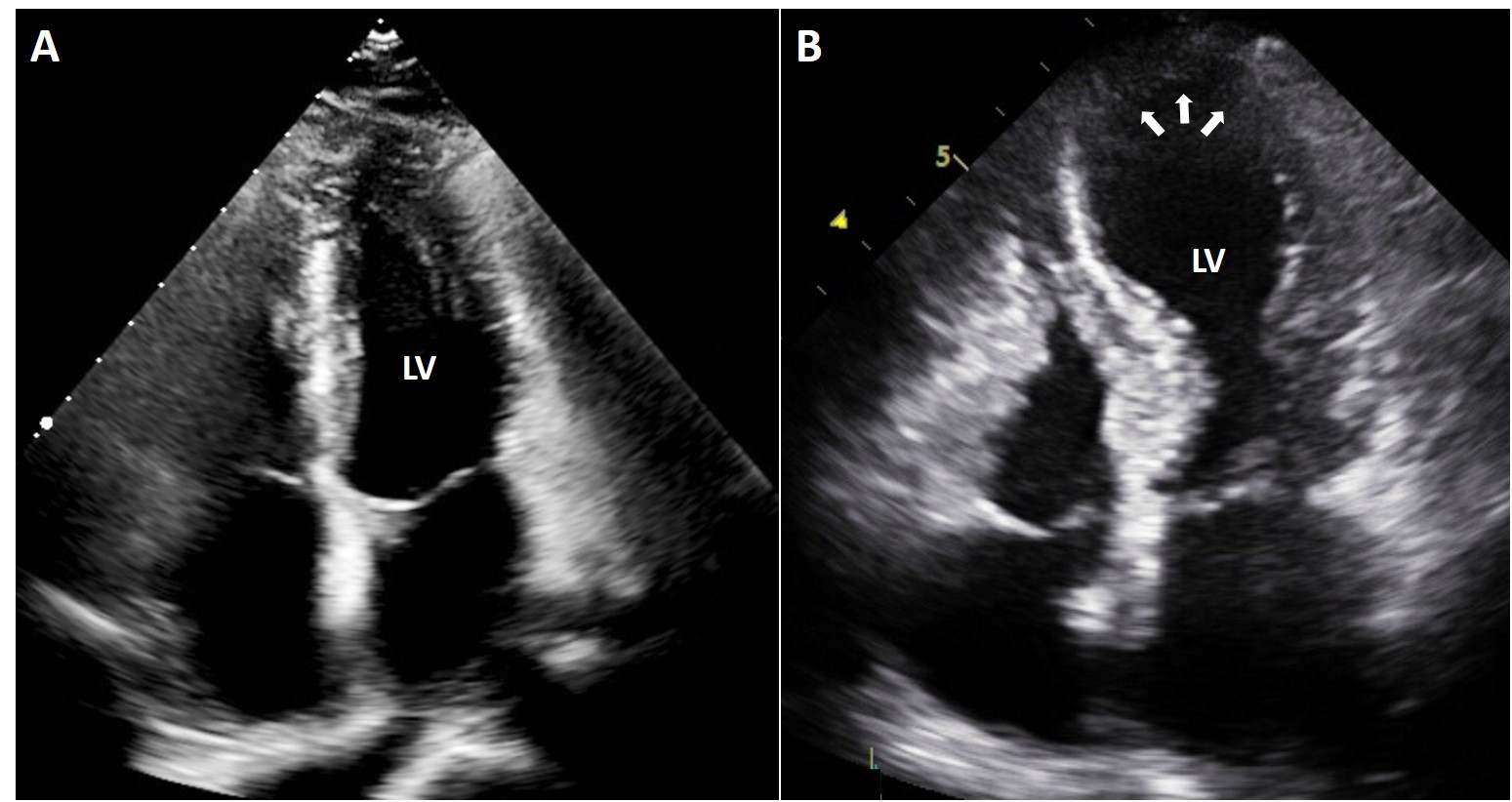 Echodiagram